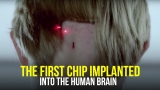 “This Could Be a Tragedy For Humanity” | The First Brain Chip Implant