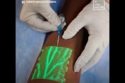 New medical technology helps nurses insert an IV on the first try
