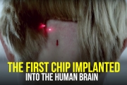 “This Could Be a Tragedy For Humanity” | The First Brain Chip Implant